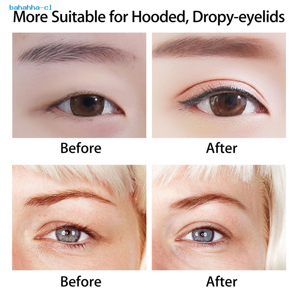 Ojos Con Doble Parpado | peacecommission.kdsg.gov.ng