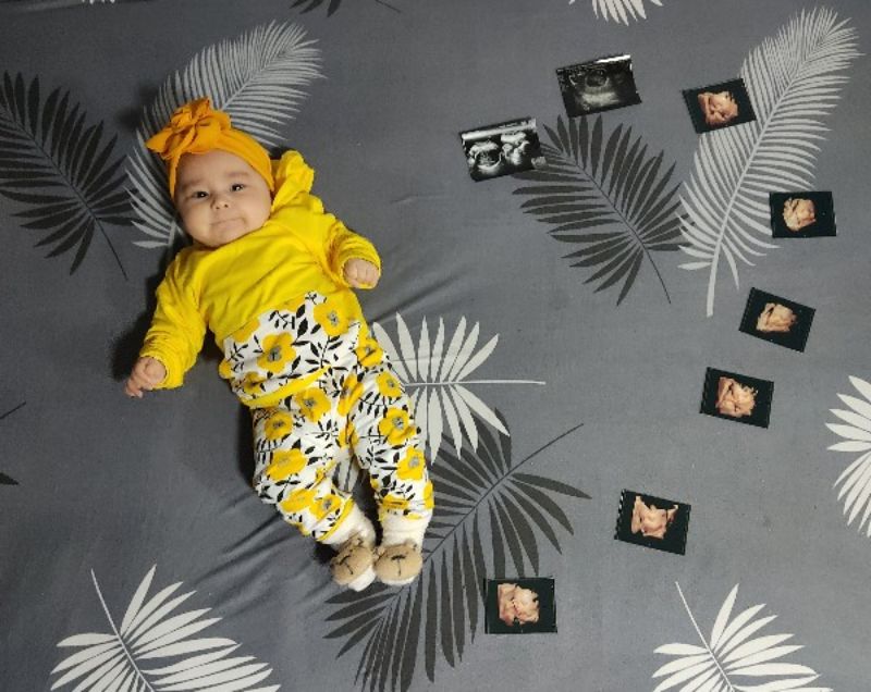 de 6 a 23 meses amarillo amarillo Talla:6 meses Camiseta de manga corta para bebé niña con diseño de Minnie y Mickey 3 colores 